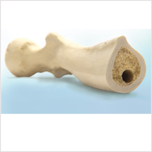 ǿֻùģ3B ORTHObones߼